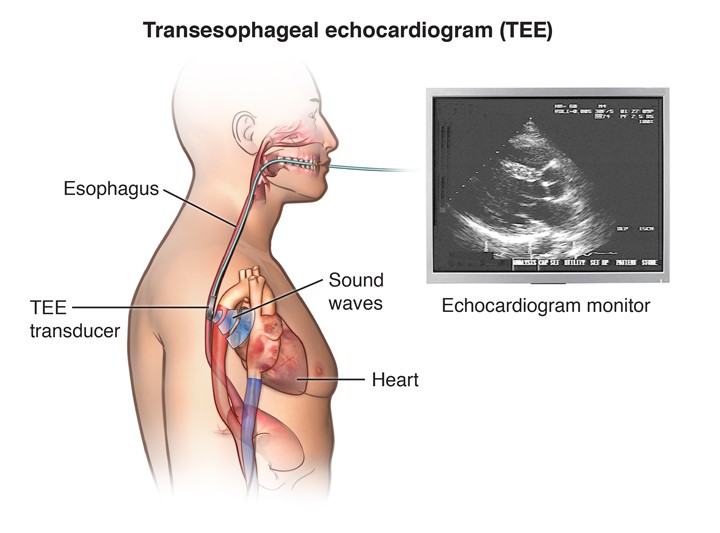 Transesophageal Echocardiography TEE Leesburg