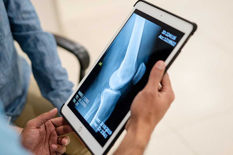 Doctor sharing knee x-ray with patient on tablet screen